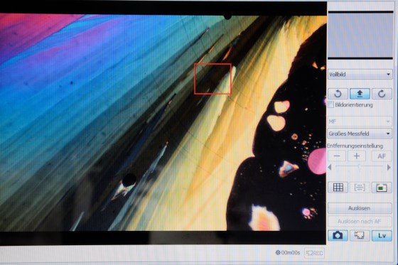 Das mikroskopische Bild auf dem Bildschirm.